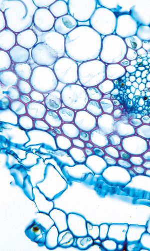 Corallorhiza trifida Châtel., © 2022, Hugo Berger – Stängel, 400x
