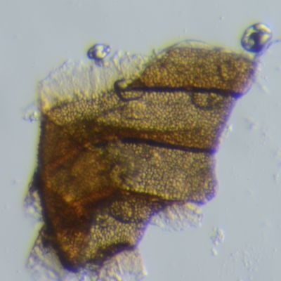 Nitella mucronata (A. Braun) Miq., © 2015, D. Auderset Joye – Le motif finement réticulé de la membrane des oospores de Nitella mucronata se voit par transparence.